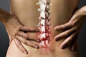 An Introduction to Back Pain Medication