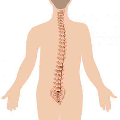 Lumbar Scoliosis