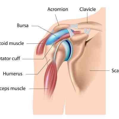 Shoulder Tendonitis