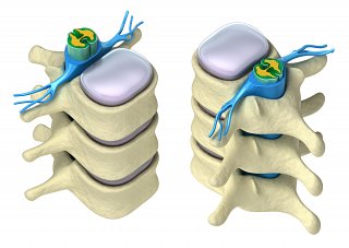 Anatomy of the Spine II